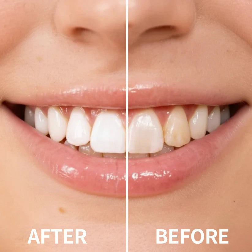 Smileasego™ Tooth Polisher — Instantly Whiter Smile🦷