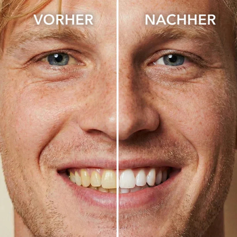 Smileasego™ Tooth Polisher — Instantly Whiter Smile🦷