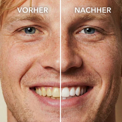 Smileasego™ Tooth Polisher — Instantly Whiter Smile🦷